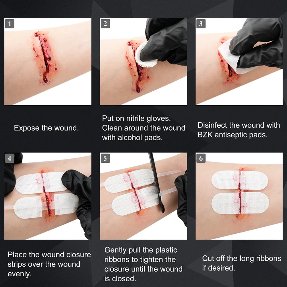 RHINO RESCUE Zip Stitch 6pcs with Wound Dressings