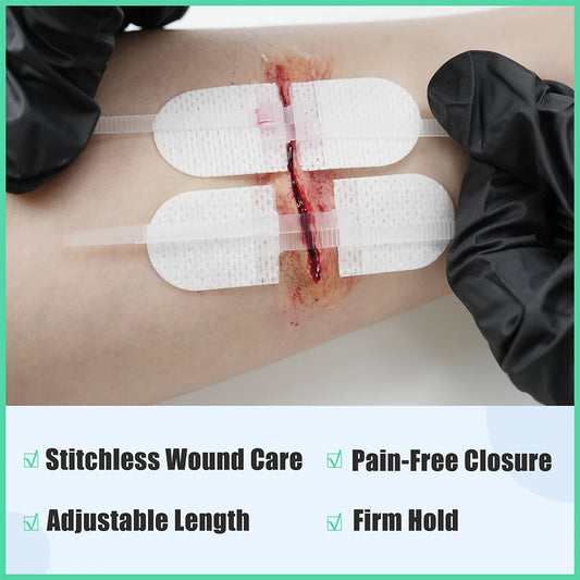 RHINO RESCUE Zip Stitch 6pcs with Wound Dressings