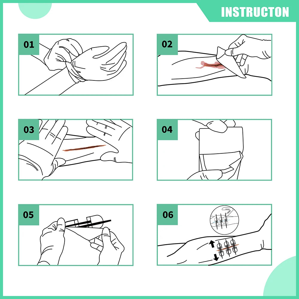 RHINO RESCUE Zip Stitch 6pcs with Wound Dressings